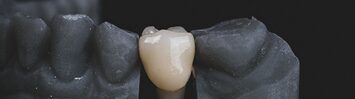 A tooth is embedded in a dental mould.